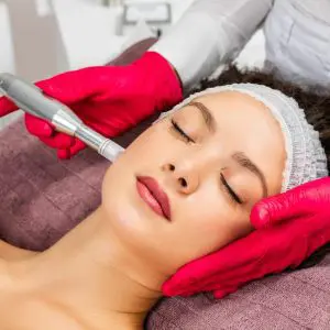 What age is best for microneedling
