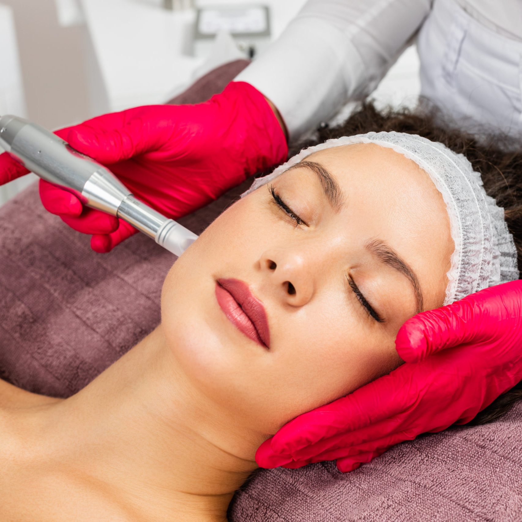What age is best for microneedling