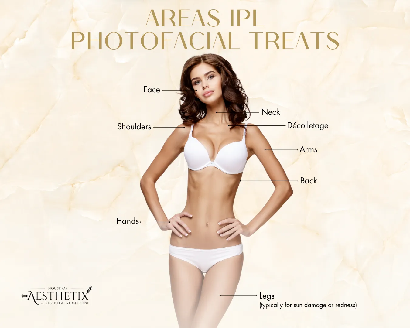 Graphic listing areas that IPL treats