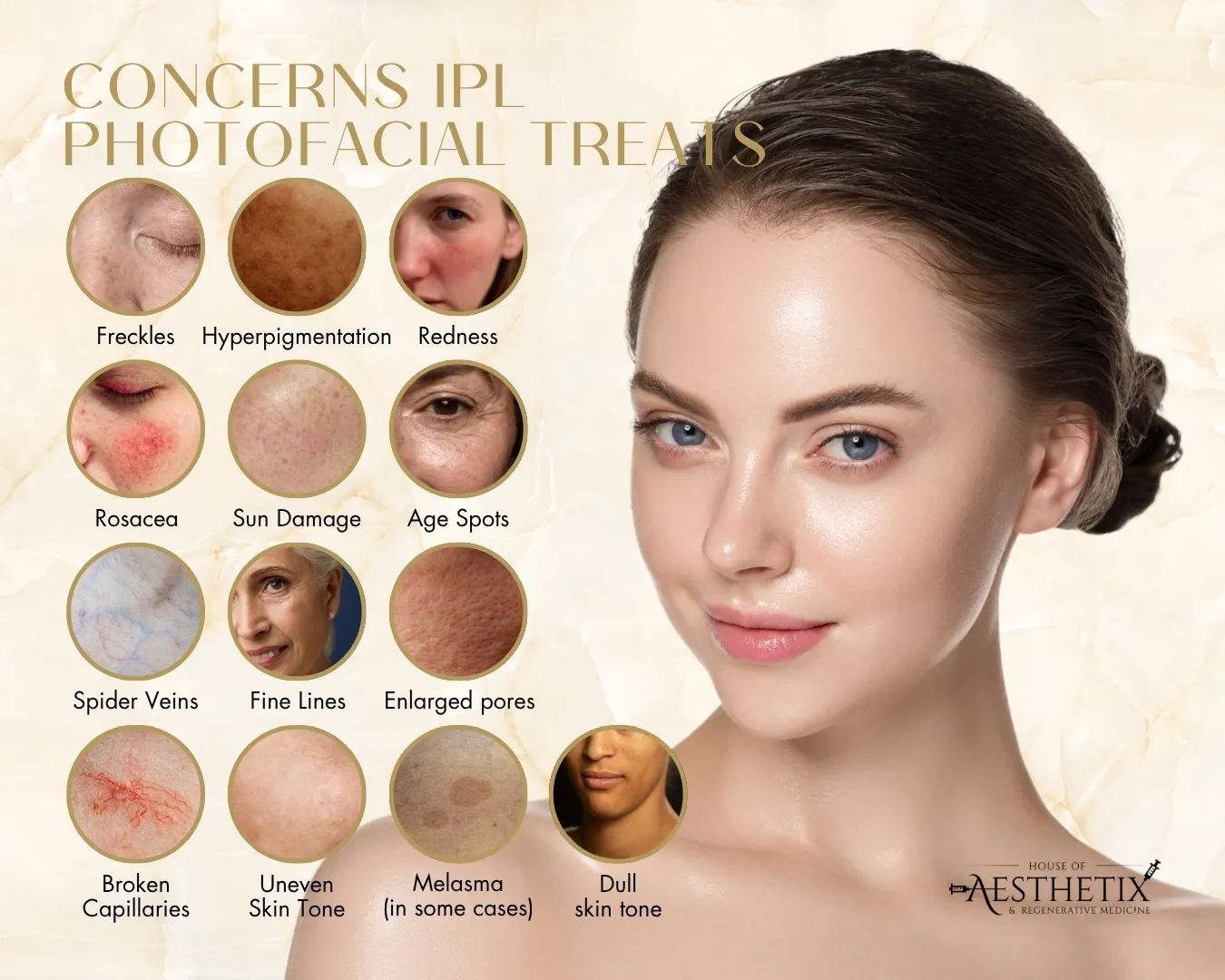 Graphic listing concerns that IPL treats